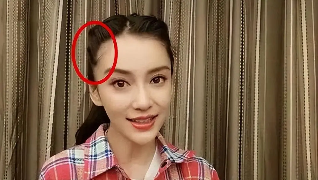 发量少的女明星有哪些_杨幂赵丽颖金晨假发片_女明星脱发严重