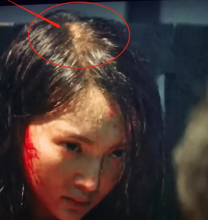 女明星脱发严重_发量少的女明星有哪些_杨幂赵丽颖金晨假发片